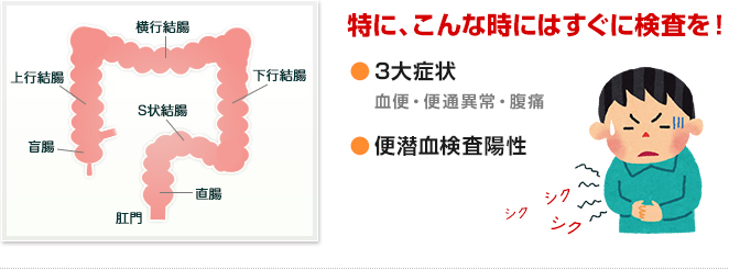 大腸内視鏡検査